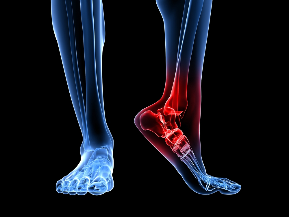 Pain in calf on sale and heel of foot